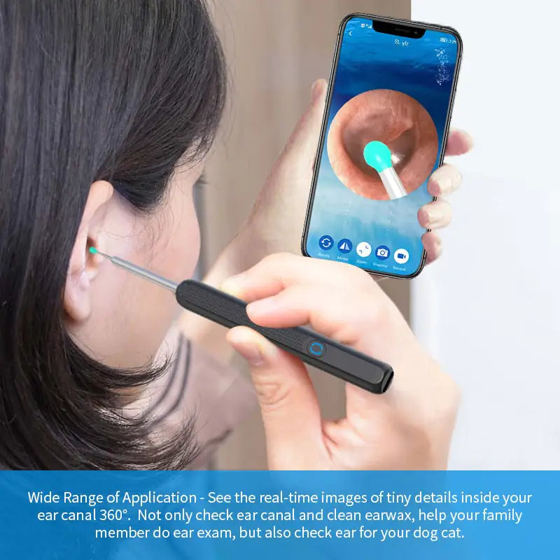 Towers E-comm™ LED Ear Cleaning Kit - Variety Products Market